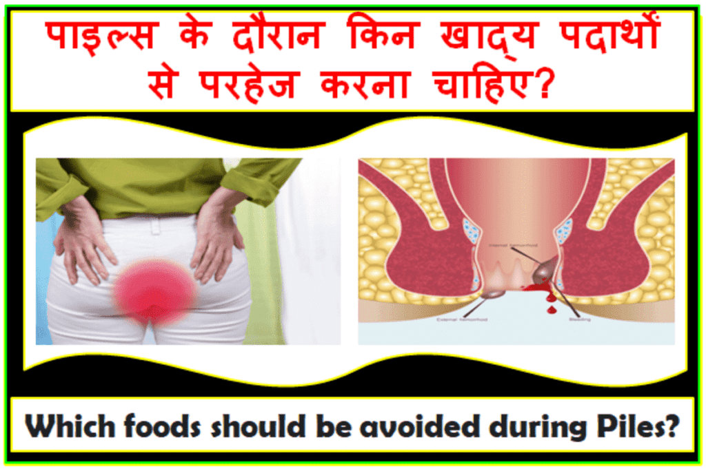 Which Foods Should Be Avoided During Piles पइलस क दरन